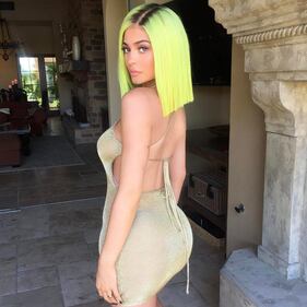 Kylie Jenner e la sexy cicatrice 23