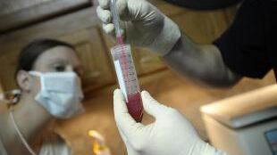Vaccino italiano contro l'Aids: abbatte 90% del virus latente