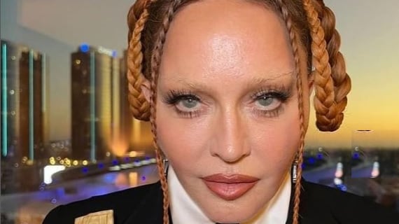 "Mai scusata, non inizierò ora". Madonna replica alle critiche sul suo aspetto