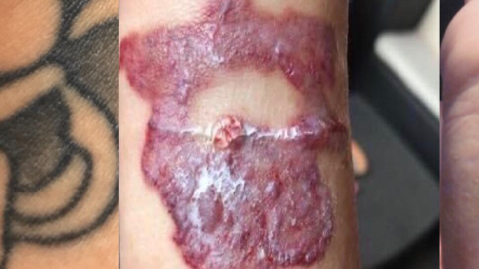 Schiaffo dei giudici all'agente: via per un vecchio tatuaggio