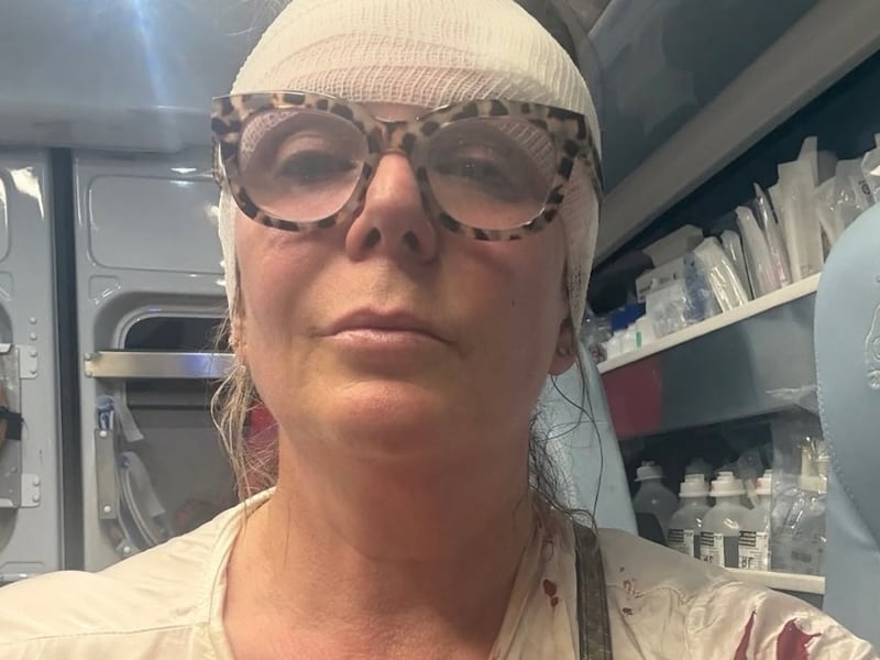 “Picchiata perché passavo col cane, per l’islam non è gradito”. La furia del marocchino sulla donna