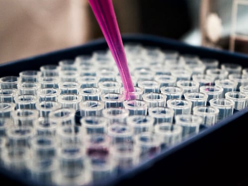 Cancro: nel 2018 i decessi saranno 9 milioni