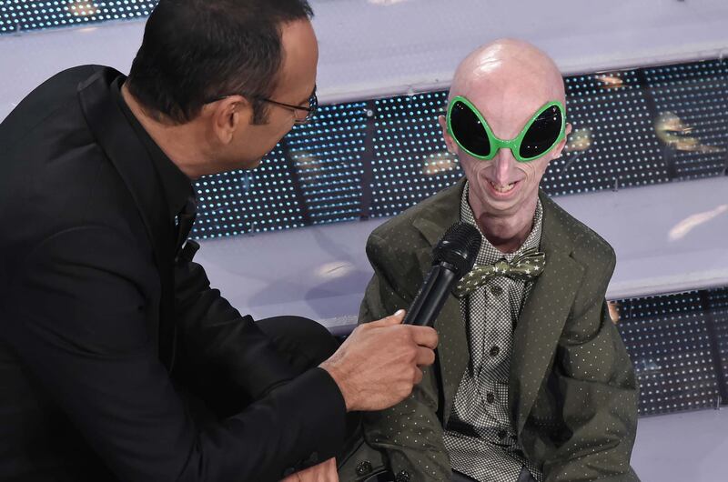 Sammy Basso, il più longevo malato di progenia 5