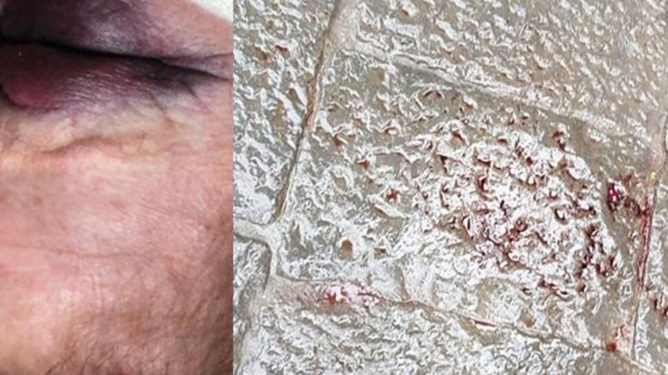 Napoli, violenza inumana dei ladri: massacrata e lasciata in un lago di sangue