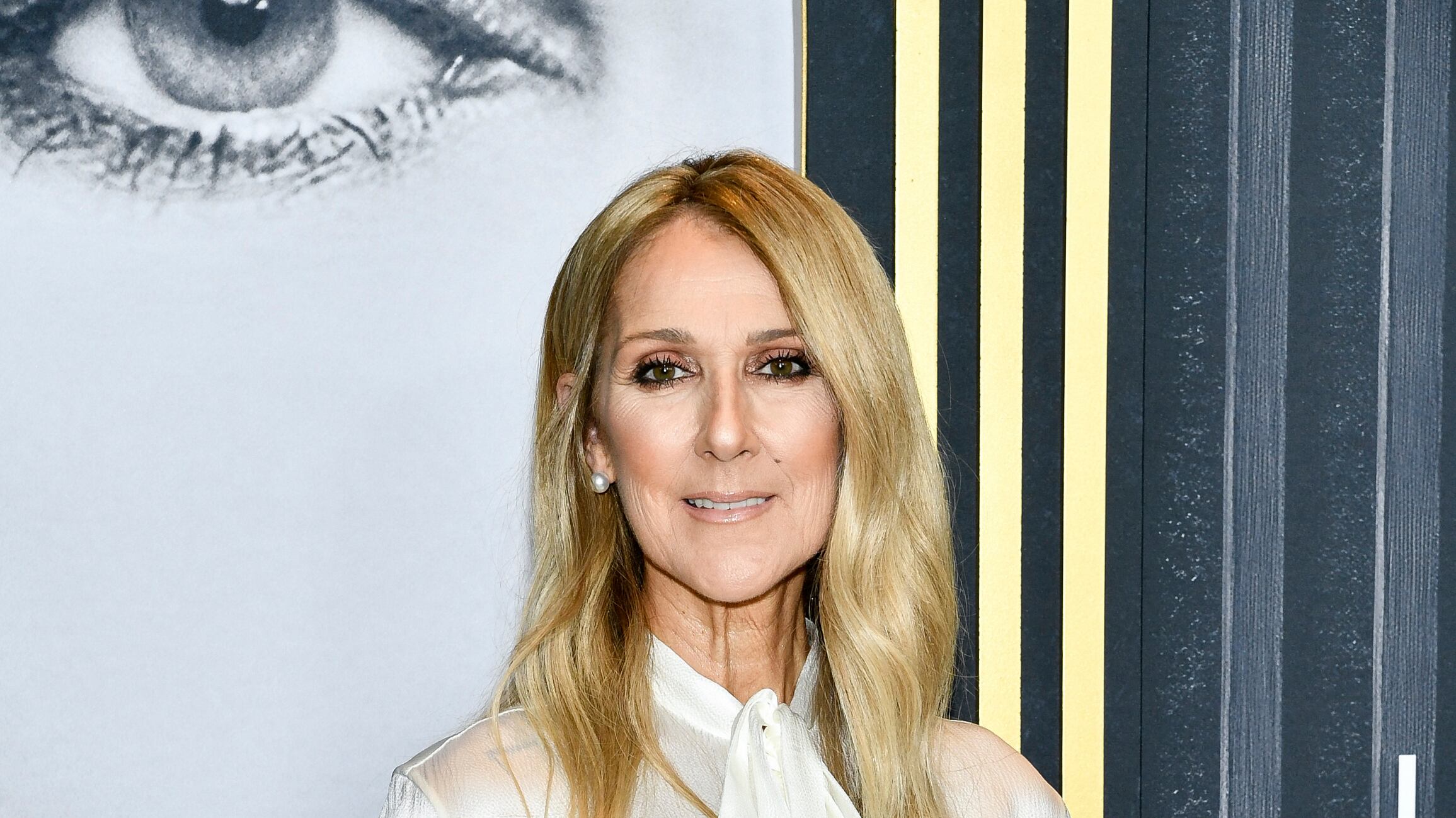 Cos'è la sindrome dell'uomo rigido che ha colpito Celine Dion: sintomi e cure