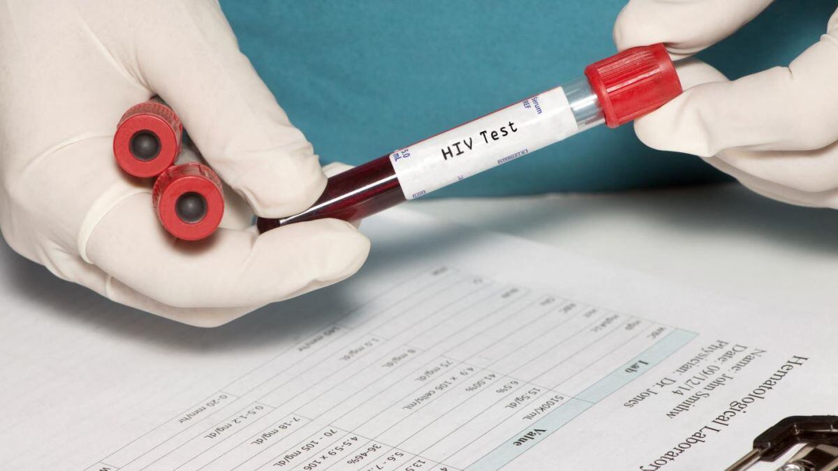 Test dell'HIV: come e quando sottoporsi al test