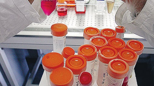 Staminali, ok primi test per Sla: trapiantate cellule su sei pazienti