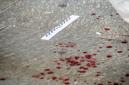 Aggressione choc in Largo la Foppa 2