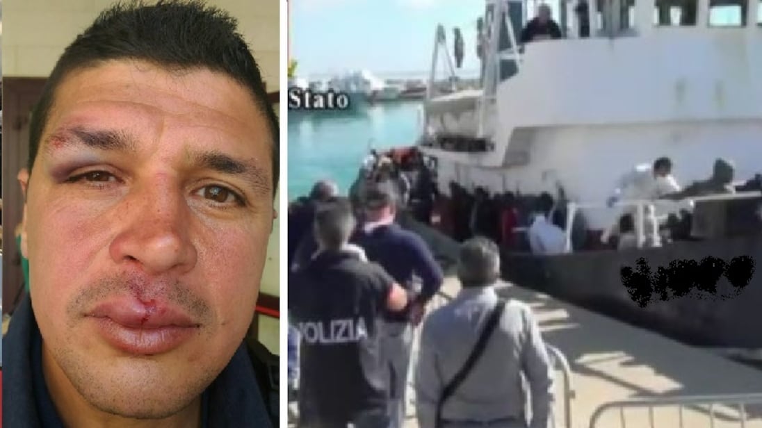 Migranti prendono a testate due agenti. Foto choc: l'ira della polizia