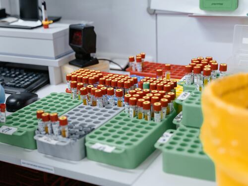 Un solo esame del sangue per scovare 12 tipi di tumori prima dei sintomi