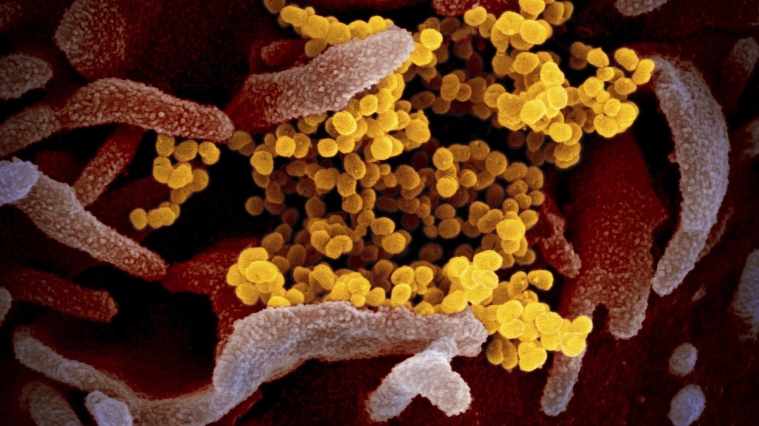 Coronavirus, la rivista scientifica: "L'Europa ha fatto poco e tardi"