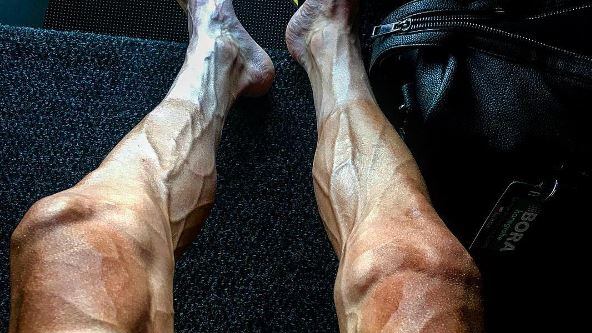 Tour de France, la sconvolgente foto delle gambe di Poljanski