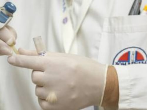 Tumore al pancreas, 15enne inventa un test per diagnosticarlo precocemente
