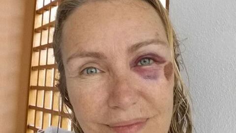 Brutto infortunio per Licia Colò. "Ho rischiato di rompermi la testa"