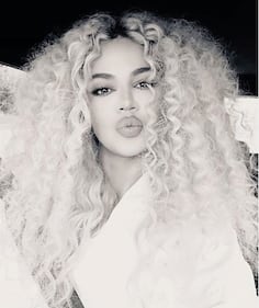 Khloe Kardashian sempre più irriconoscibile 9