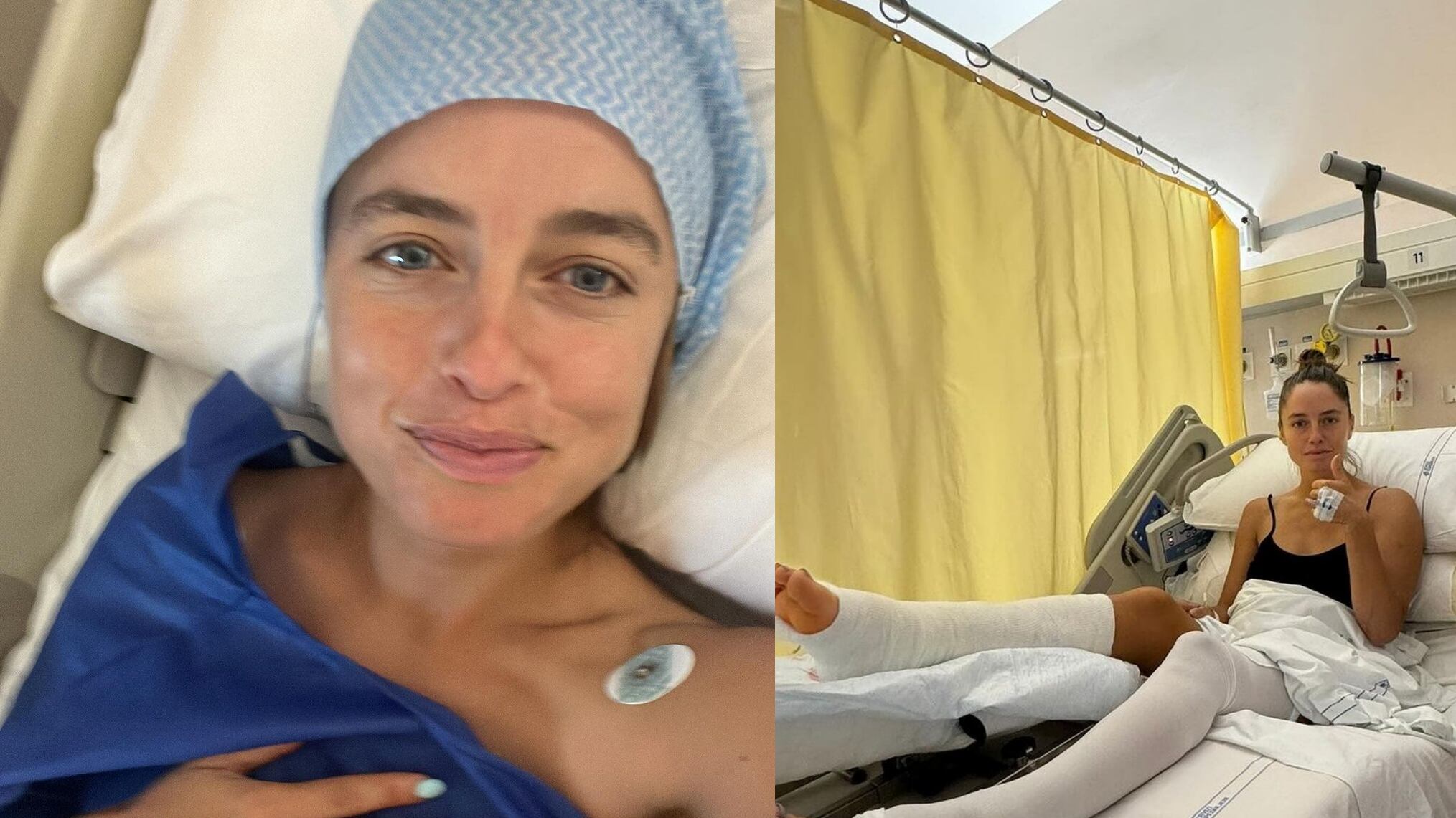 L'incidente poi l'intervento alla gamba. Matilde Gioli in ospedale