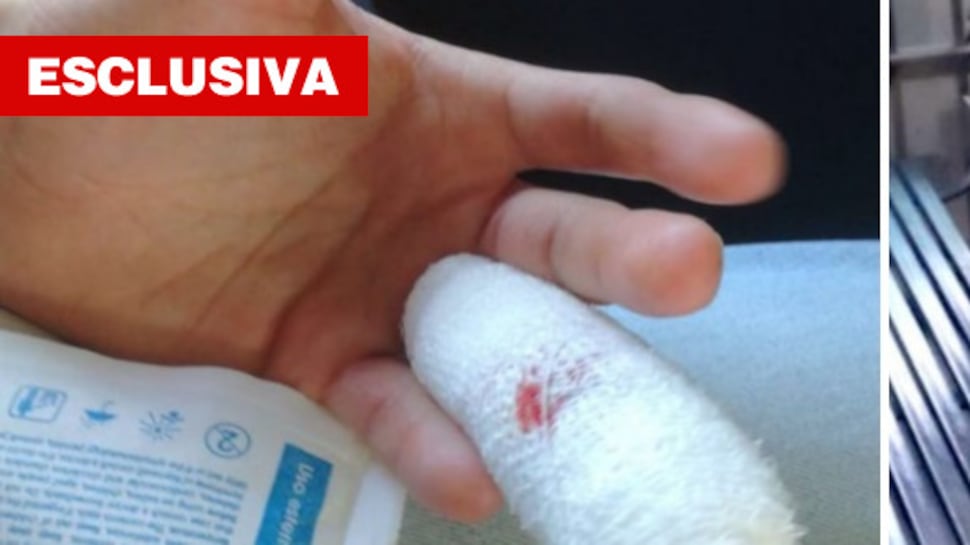 Torino, nigeriano morde poliziotto e gli strappa la falange