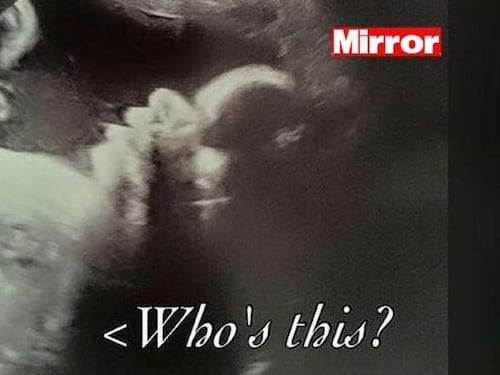 Fa un'ecografia, ma nelle foto spunta un volto strano