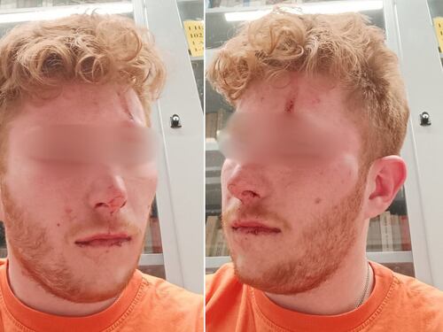 Un mese di violenze rosse