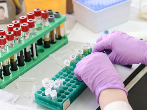 Artrite reumatoide: nuove speranze di cura