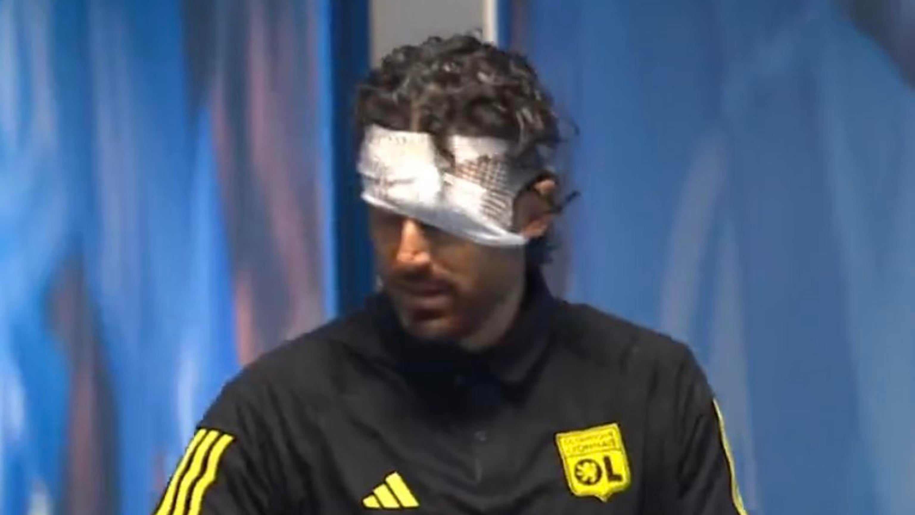 Sassaiola dei tifosi del Marsiglia: feriti al volto Fabio Grosso e il suo vice