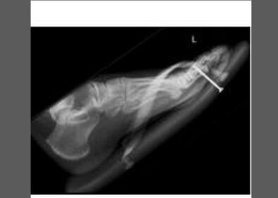Pazze radiografie: gli oggetti che possono finire nel corpo umano 7