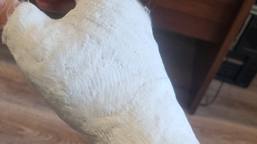 Straniero fermato dopo un furto, l'agente si rompe la mano. Ma i passanti protestano: "È stato sgradevole"
