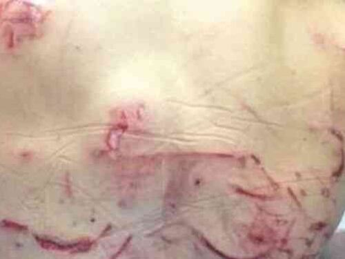 "Ho lottato con l'orso, io un miracolato"