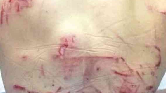 "Ho lottato con l'orso, io un miracolato"