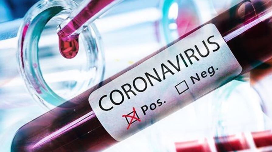 Coronavirus, pronta la prima fiala del vaccino: così "uccide" Covid-19
