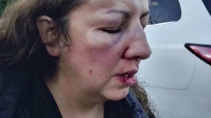 Bulle pestano a sangue mamma di una sedicenne fuori dalla scuola