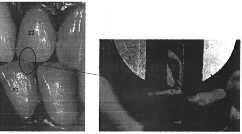 denti