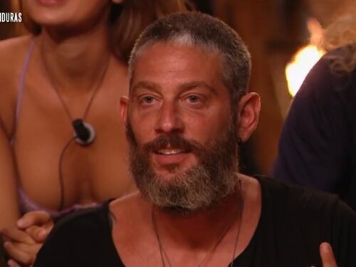 Il ginocchio e l'addio all'Isola dei Famosi. Cosa è successo davvero a Edoardo Tavassi