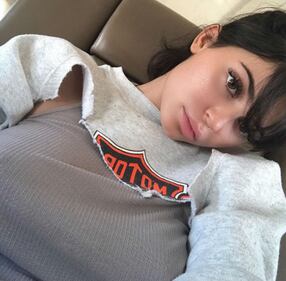 Kylie Jenner e la sexy cicatrice 8