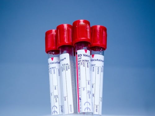 Coronavirus, un nuovo test del sangue in gravidanza