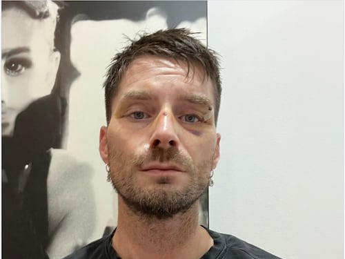Pugni in faccia e poi la rapina: direttore di Novella 2000 aggredito a Milano da tre ventenni