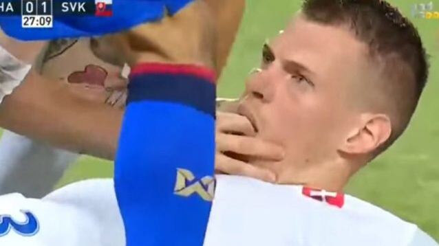 Nazionali, paura in campo per Skrtel. Può soffocare, lo aiuta il compagno