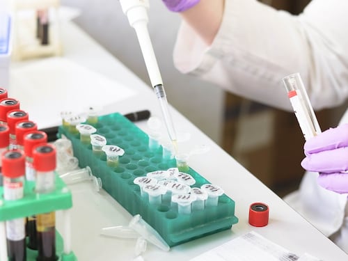 Anakinra, farmaco anti artrite contro i casi gravi di Covid-19