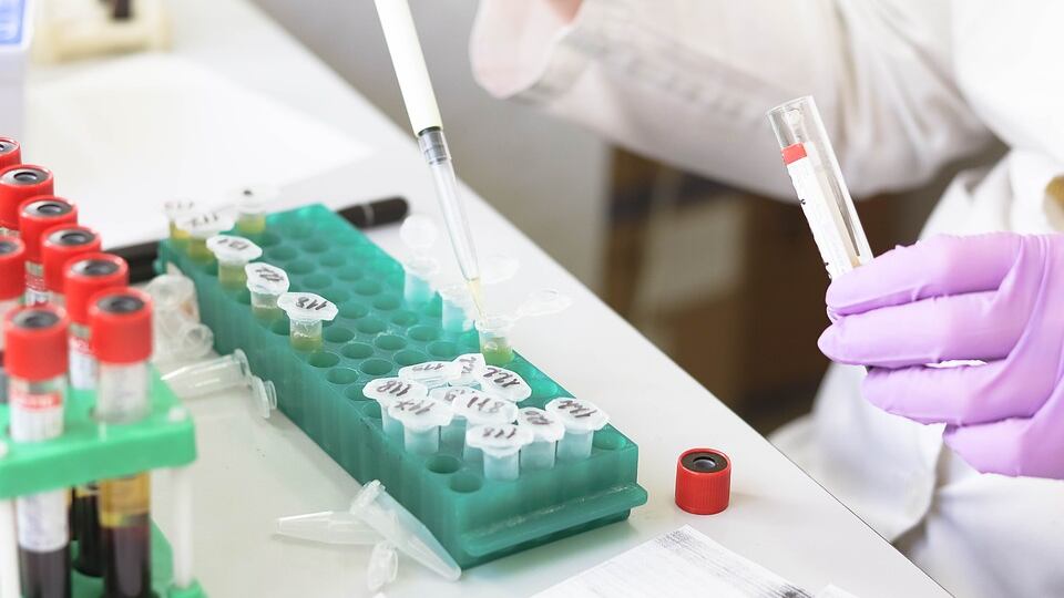 Anakinra, farmaco anti artrite contro i casi gravi di Covid-19