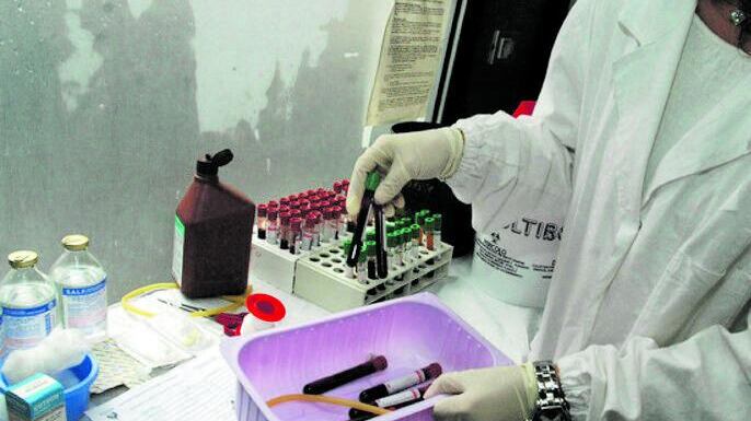 Epatite A, 113 casi in Campania (uno grave): colpa dei frutti di mare