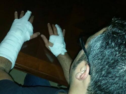 Arresta spacciatore che lo picchia. Ma "ai domiciliari" finisce il poliziotto