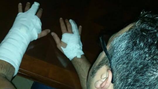 Arresta spacciatore che lo picchia. Ma "ai domiciliari" finisce il poliziotto