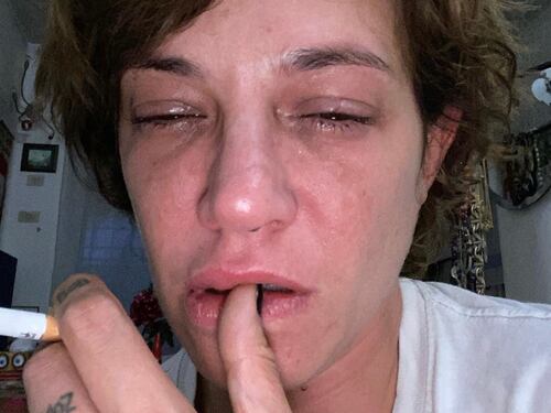 Lo strazio social di Asia Argento: "Volete il dolore? Eccolo"