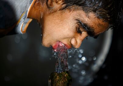 Nepal, soffrono di una malattia che li rende pelosissimi 12