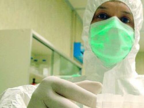 Sla, scoperto il killer molecolare: aperta la strada a nuovi farmaci