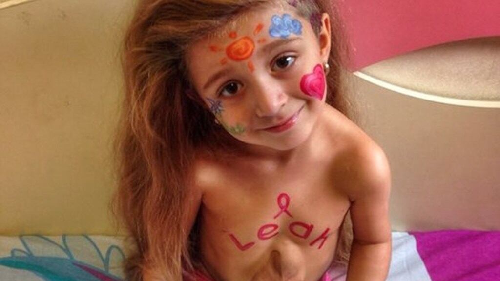 La (dura) battaglia della bambina: il cuore le batte "fuori" dal petto