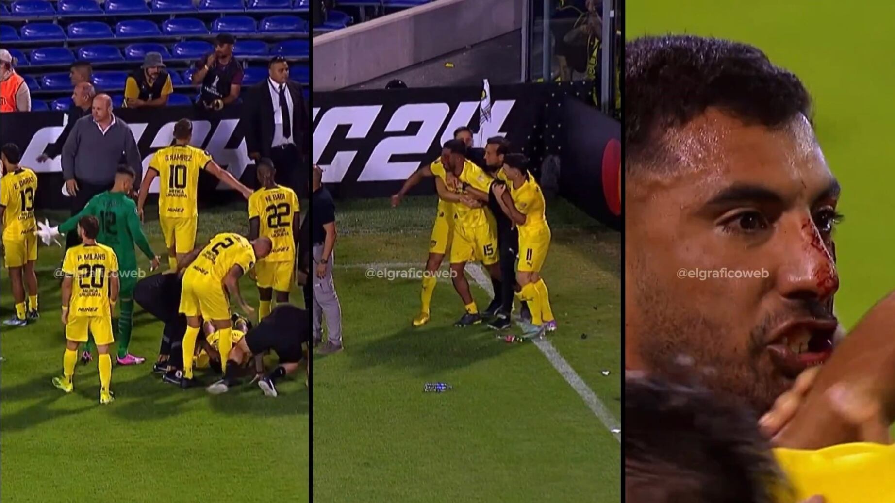 Choc durante la partita: l'ex della Fiorentina colpito al volto con una pietra - VIDEO