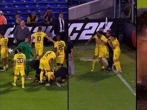 Choc durante la partita: l'ex della Fiorentina colpito al volto con una pietra - VIDEO