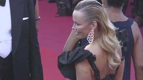Cannes, Pamela Anderson sul red carpet con il braccio pieno i lividi 2