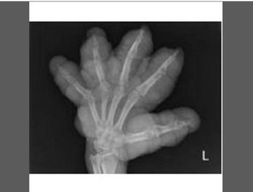 Pazze radiografie: gli oggetti che possono finire nel corpo umano 6